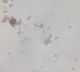 Fuligo septica image