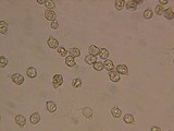 Nolanea pusillipapillata image