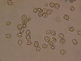 Nolanea pusillipapillata image