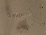 Scutellinia minor image