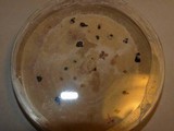 Pestalotiopsis microspora image