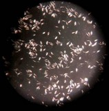 Pestalotiopsis microspora image