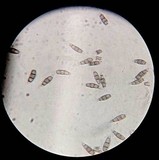 Pestalotiopsis microspora image