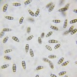 Pestalotiopsis microspora image