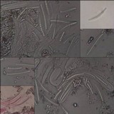 Enterographa elaborata image