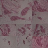Leptogium ferax image