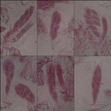 Leptogium ferax image
