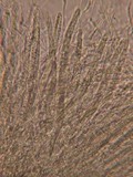 Lophodermium melaleucum image