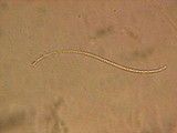 Lophodermium melaleucum image