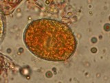Allodus podophylli image