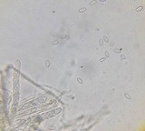 Geopyxis carbonaria image