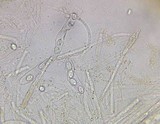 Gyromitra melaleucoides image