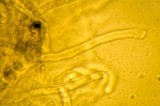 Ryvardenia campyla image