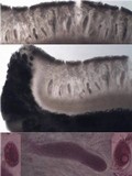 Ochrolechia tartarea image