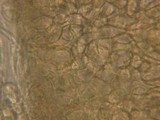 Ascobolus albidus image