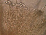 Ascobolus albidus image