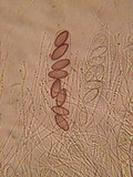 Ascobolus albidus image
