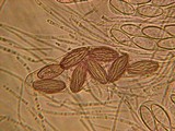 Ascobolus albidus image