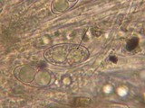 Neottiella albocincta image