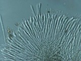 Rutstroemia bulgarioides image