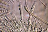 Mitrula elegans image
