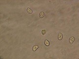 Sebacina epigaea image