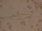 Inocybe leiocephala image