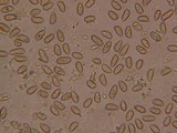 Inocybe leiocephala image