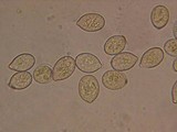 Botryobasidium conspersum image