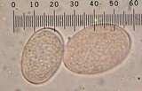 Morchella snyderi image