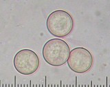 Plicaria endocarpoides image