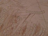 Pseudoplectania nigrella image