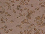 Inocybe amblyospora image
