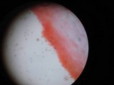 Agaricus bitorquis image