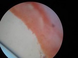 Agaricus bitorquis image