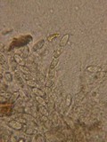 Rutstroemia calopus image