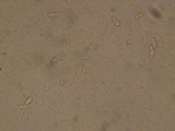 Rutstroemia calopus image
