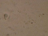 Rutstroemia calopus image