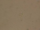 Rutstroemia calopus image