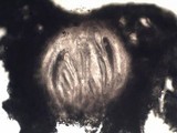 Pertusaria pertusa image