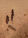 Ascobolus degluptus image