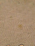 Ascobolus degluptus image
