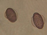 Ascobolus degluptus image