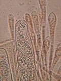 Scutellinia umbrorum image