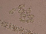 Scutellinia umbrorum image