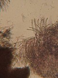 Hypomyces aurantius image