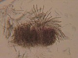 Hypomyces aurantius image