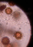 Scleroderma areolatum image