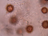 Scleroderma areolatum image