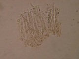 Coccomyces tumidus image